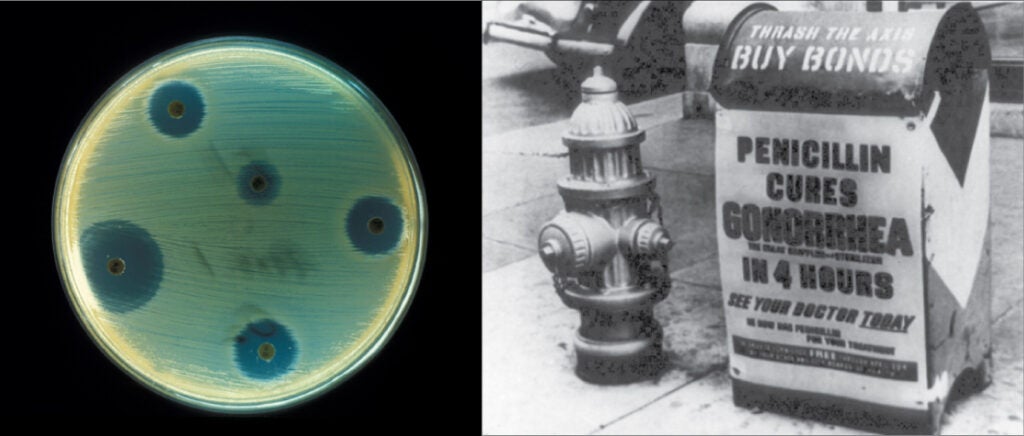 Petri dish showing antibiotic inhibition of bacteria beside a vintage penicillin advertisement.